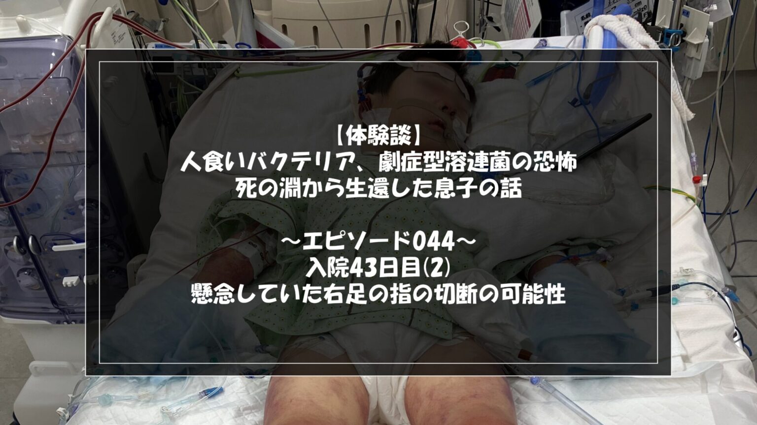 【体験談】エピソード044 懸念していた右足の指の切断の可能性 | あきらめないで！苦手克服blog
